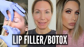 VLOG: LIP FILLER/BOTOX?!