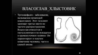 ▼Богонатова Л. Н. Паразит Власоглав▼|▼Bogonatova L.N. Parazit Vlasoglav▼