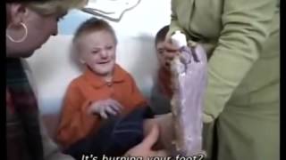 изуродованные дети пережившие Чернобыль