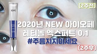 2020년 주름완벽대비 아이오페 레티놀 엑스퍼트와 함께 주름 관리 해보아요