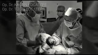 İKİZ GEBELİK 38. HAFTADA SPİNAL ANESTEZİLİ DOĞUM ANI(BİRİNCİ ERKEK,İKİNCİ KIZ)-ÇİFT YUMURTA İKİZLERİ