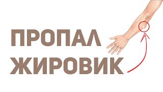 Улучшение сна, хорошое настроение, лечение жировика.