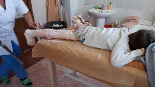 СНИМАЕМ ГИПСЫ/ ОЧЕНЬ СЛОЖНО ВСЕ ОКАЗАЛОСЬ/ ЯРОСЛАВ УЧИТСЯ ВСЕМУ ЗАНОВО/ ДИСПОРТ ПРИ ДЦП