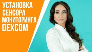 Как устанавливать сенсор декском G4