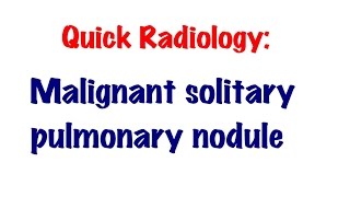 QUICK RADIOLOGY: Signs of solitary malignant pulmonary nodule