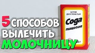 Как Лечить МОЛОЧНИЦУ у Женщин ✅5 Способов Лечения КАНДИДОЗА в Домашних Условиях
