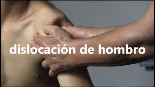 Dislocación de hombro