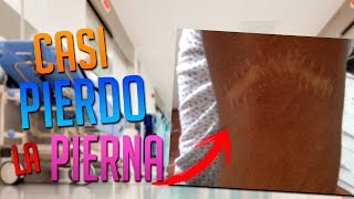EL DIA QUE CASI PIERDO LA PIERNA