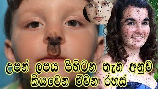 උපන් ලපය පිහිටන තැන අනුව කියැවෙන ජීවන රහස් -  birthmarks