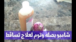 شامبو البصل طبیعي لعلاج تساقط الشعر ??مجرب ?