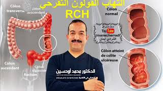 RCH  التهاب القولون التقرحي الأسباب التشخيص و التغدية المعالجة رفقة الدكتور محمد أوحسين 31/01/2018