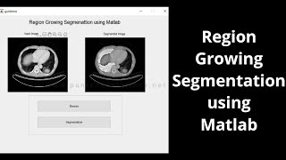 Region Growing Segmentation using Matlab