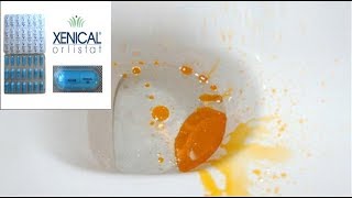 O que acontece quando se toma Xenical/Orlistat - sil olicam