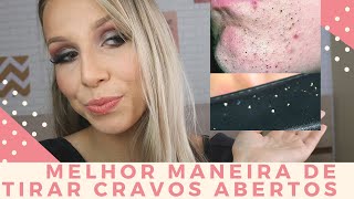 COMO TIRAR CRAVOS ABERTOS - Bruna Harmel