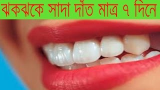 ঝকঝকে সাদা দাঁত মাত্র ৭ দিনে||Dater Poricorja||দাঁত সাদা করার উপায় জেনে নিন