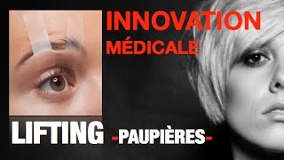 LIFTING DES PAUPIÈRES sans cicatrice - PlexR® en vidéo avant/après