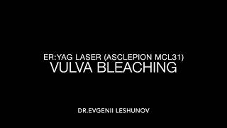 Bleaching of vulva and perianal area by Er:YAG laser