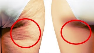 GET RID OF CELLULITE ON YOUR THIGHS, LEGS AND BUTT IN JUST 4 WEEKS