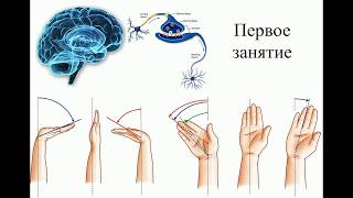 Восстановление руки после инсульта