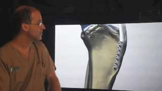 TTA for surgical repair of the CCL injury in the dog and cat.