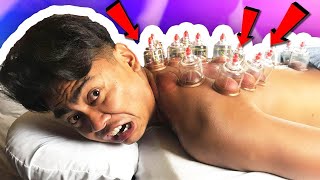GUAVA JUICE TRIES CUPPING FOR THE FIRST TIME!