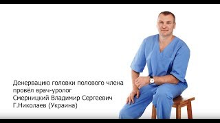 Лечение преждевременного семяизвержения - Денервация головки полового члена