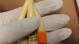 ?Sonda Vesical de 3 vias