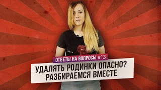 Родинки: какие нужно удалять? (Ответы на Вопросы)