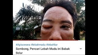 Sombong, Pencari Lebah Madu ini Babak Belur