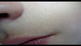 Remove Upper Lip Hair Forever with Just Two Ingredients