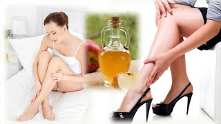Como Curar Las Varices Con Vinagre De Manzana Y Otros Remedios Caseros