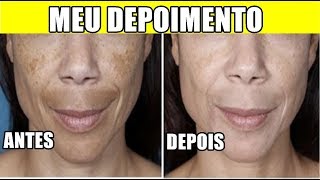 BEAUTY CLEAN CREME CLAREADOR - BEAUTY CLEAN FUNCIONA MESMO? BEAUTY CLEAN ORIGINAL ONDE COMPRAR?