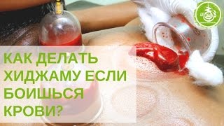Как делать Хиджаму если боишься крови? | Обучение Хиджаме