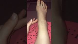Another injury to my right foot-possibly broken toe