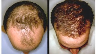 Копеечное средство для бешеного роста волос