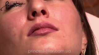 Коррекция формы губ Princess Filler