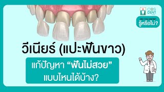 วีเนียร์สามารถช่วยแก้ไขปัญหาฟันไม่สวย