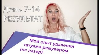 Удаление татуажа. Отзыв. Часть 3.