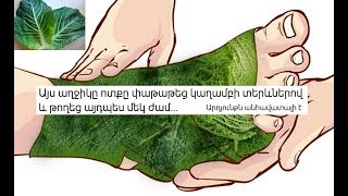Աղջիկը ոտքը փաթաթեց կաղամբի տերևներով և թողեց այդպես մեկ ժամ... Արդյունքն անհավատալի է