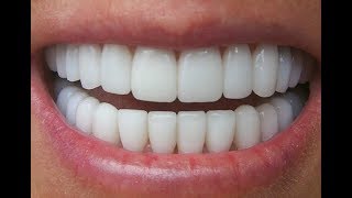 وصفة الثوم العجيبة لعلاج الم الاسنان,,,ستفيدك جدا رائعة للتخص من الالم ان شاء الله !!