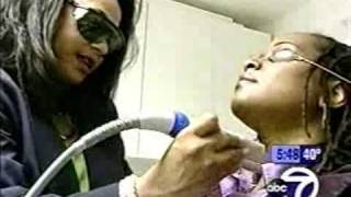 ABC 7 Cutera Darker Skin Tone Care - IMD Laser Clinic