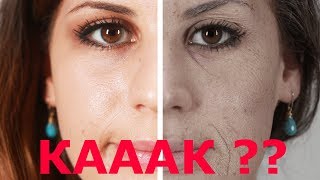 Естественный Цвет Лица Вернется Очень Быстро