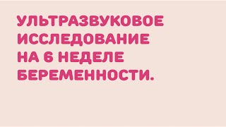 УЗИ 6 неделя беременности