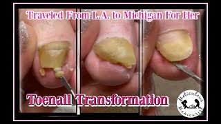 ? Pedicure Tutorial: Satisfying Toenail Transformation ?