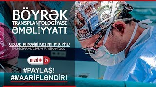 Boyrek kocurulmesi emeliyyati Op Dr Mircelal Kazimi MD PhD Umimi Cerrah Cerrah Transplantoloq