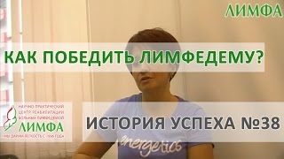 Отзыв о лечении в НПЦ "ЛИМФА".  История успеха №38 в победе над лимфедемой.