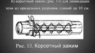 Назначение пожарных рукавов, рукавного оборудования и стволов