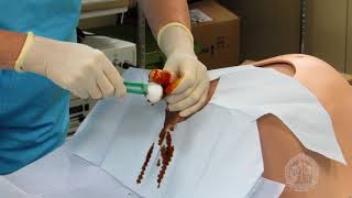 Procedure - Foley Bladder Catheterization MALE v2019 [ASE]