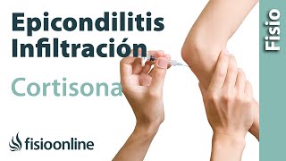 Epicondilitis o codo de tenista y las  infiltraciones de cortisona o corticoides