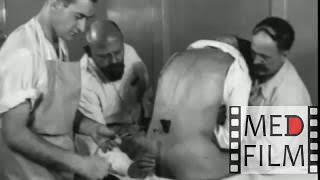 Spinal anesthesia, Dr. Lorenz Bohler, Vienna, 1933 ©